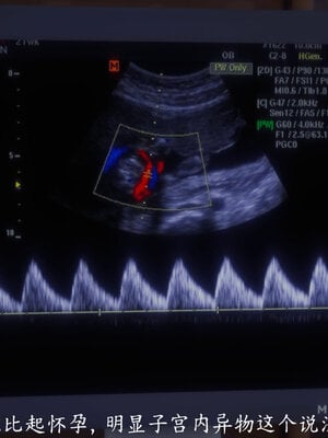 [敲西六]新乔安传4.2_045